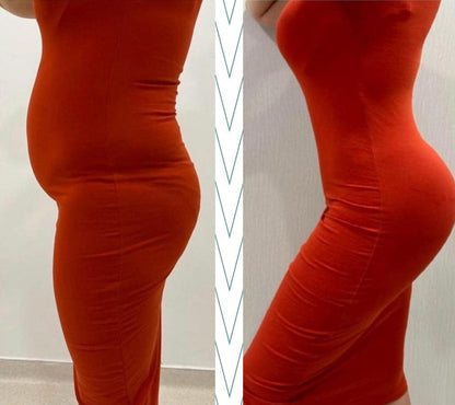 Braga Moldeadora SlimShape - Tecnología Exclusiva FIR ION [COMPRA 1 Y LLEVA 2]